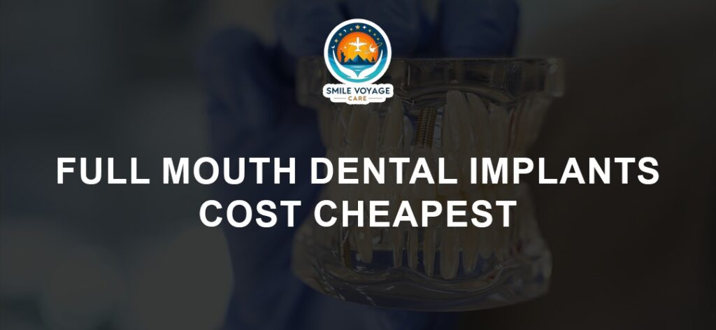 full mouth dental implants cost cheapest