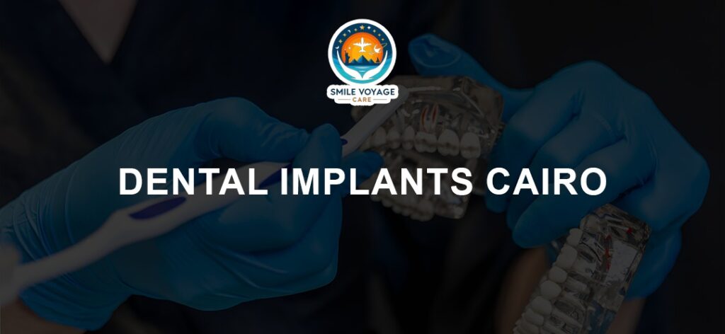 dental implants Cairo