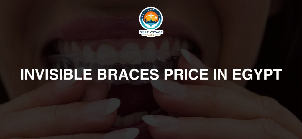 invisible braces price in egypt